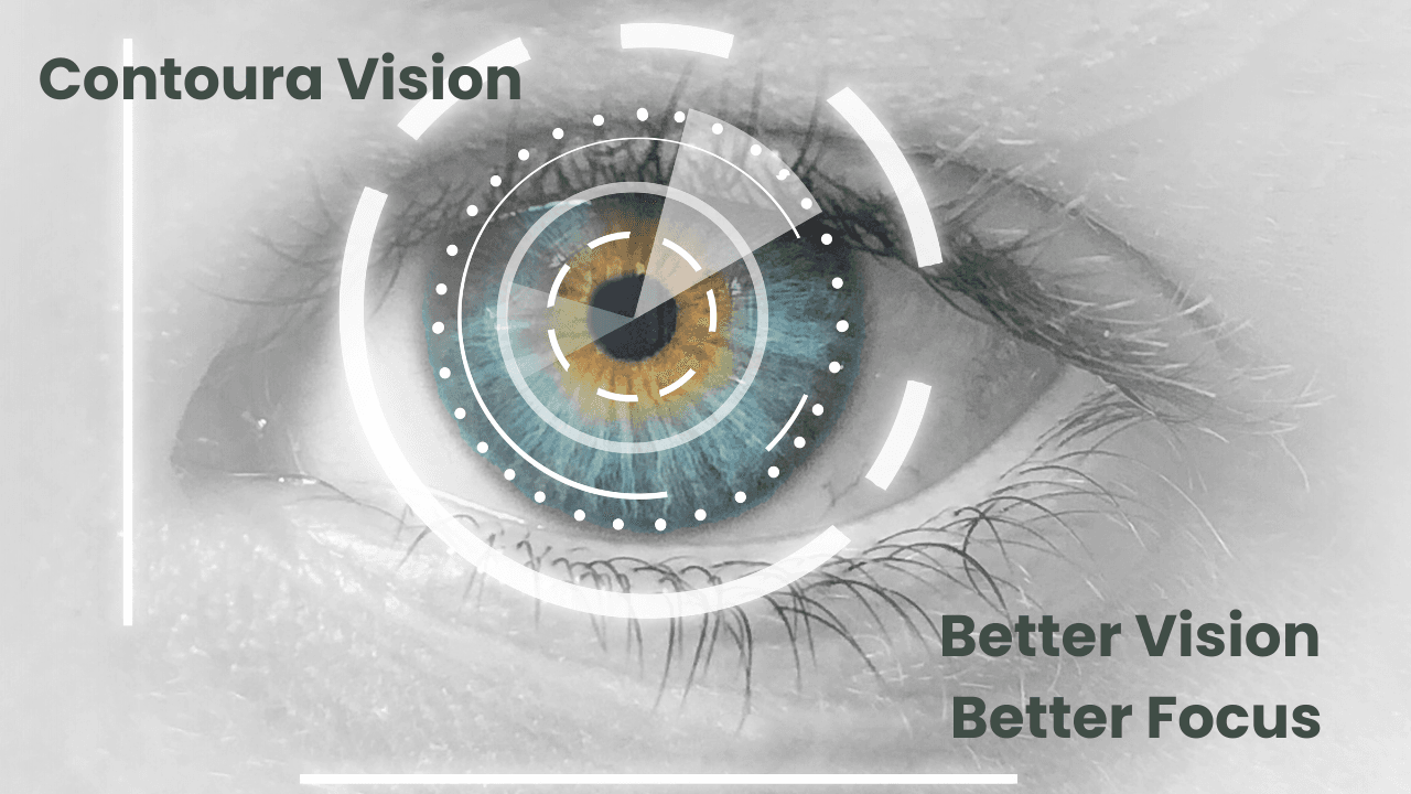 lasik surgery