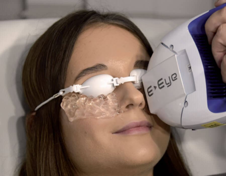 dry eye treatment