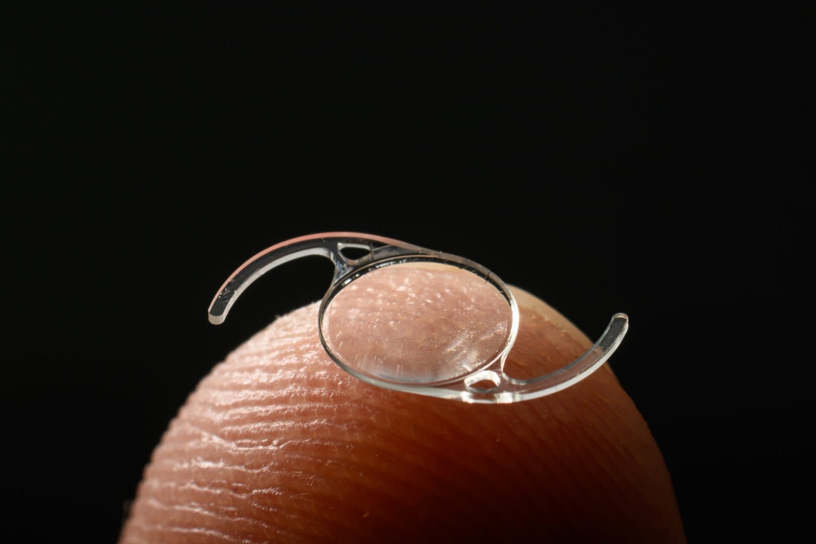 cataract surgery delhi