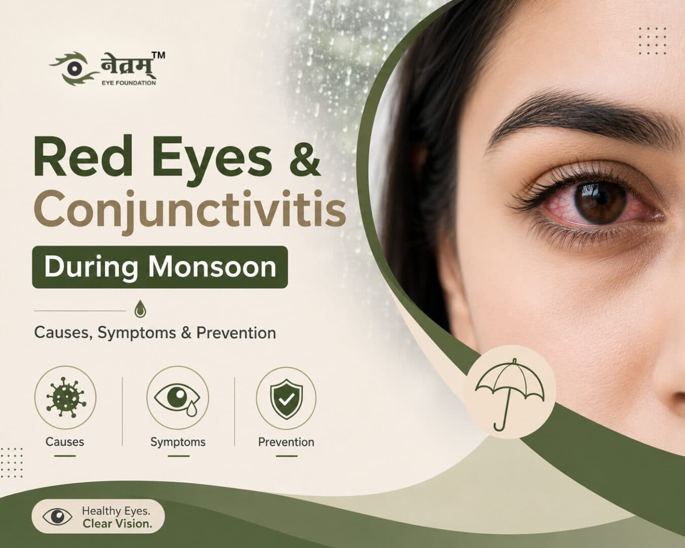 Conjunctivitis During Monsoon – Red Eyes Symptoms and Prevention